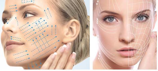 Facial rejuvenation